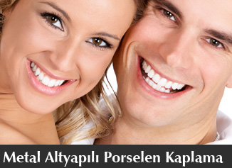Porselen Kaplama